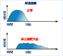 前立腺肥大症6