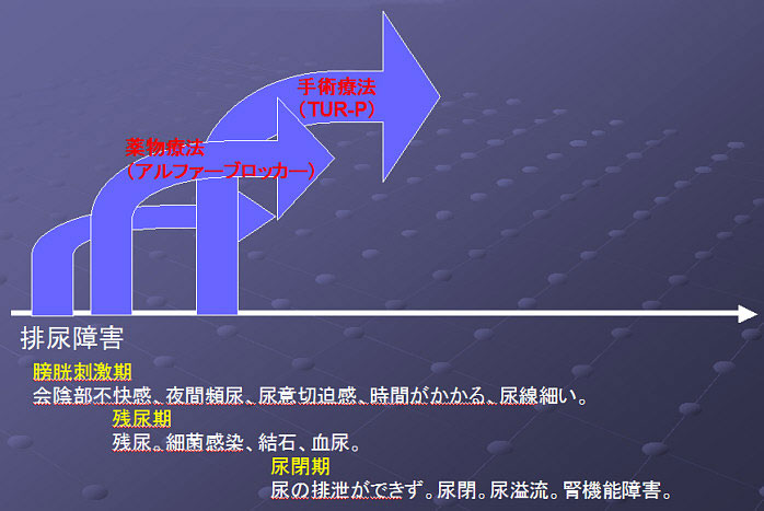 前立腺肥大症11